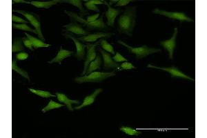 Immunofluorescence of purified MaxPab antibody to TRAF4 on HeLa cell. (TRAF4 抗体  (AA 1-470))