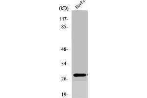 Western Blot analysis of COLO205 cells using Six3/6 Polyclonal Antibody (SIX Homeobox 6 抗体  (Internal Region))