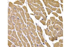 Immunohistochemistry of paraffin-embedded Mouse heart using GLUT4 Polyclonal Antibody at dilution of 1:100 (40x lens). (GLUT4 抗体)