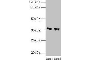 Western blot All lanes: RDH11 antibody at 10 μg/mL Lane 1: PC-3 whole cell lysate Lane 2: Hela whole cell lysate Secondary Goat polyclonal to rabbit IgG at 1/10000 dilution Predicted band size: 36, 35, 28 kDa Observed band size: 36 kDa (RDH11 抗体  (AA 22-318))