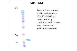 SDS-PAGE (SDS) image for Interleukin 1 eta (FIL1h) (Active) protein (ABIN5509788) (FIL1h 蛋白)