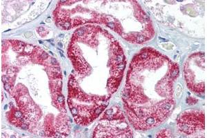 Human Kidney (formalin-fixed, paraffin-embedded) stained with AIFM1 antibody ABIN214083 at 5 ug/ml followed by biotinylated goat anti-rabbit IgG secondary antibody ABIN481713, alkaline phosphatase-streptavidin and chromogen. (AIF 抗体  (AA 211-260))