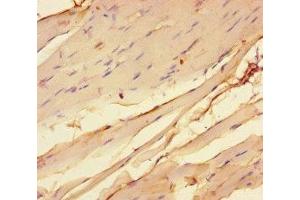 Immunohistochemistry of paraffin-embedded human skeletal muscle tissue using ABIN7142955 at dilution of 1:100 (CHRNA1 抗体  (AA 21-255))