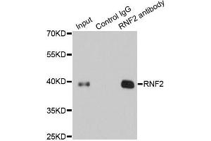 Immunoprecipitation (IP) image for anti-Ring Finger Protein 2 (RNF2) (AA 1-336) antibody (ABIN6147029)