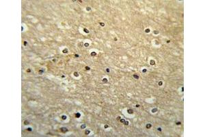 Immunohistochemistry (IHC) image for anti-Paired Box 6 (PAX6) (AA 352-380) antibody (ABIN3032127)