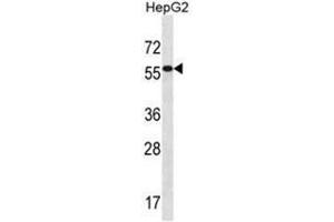 ALDH3B2 Antibody (C-term) western blot analysis in HepG2 cell line lysates (35 µg/lane). (ALDH3B2 抗体  (C-Term))