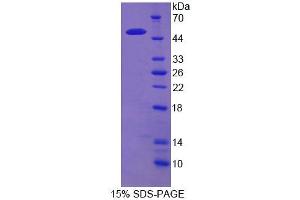 SDS-PAGE analysis of Human RTN1 Protein. (Reticulon 1 Protein (RTN1))