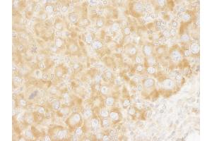 Immunohistochemistry (IHC) image for anti-Eukaryotic Translation Initiation Factor 3 Subunit A (EIF3A) (AA 860-910) antibody (ABIN7448546)