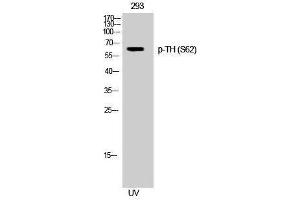 Western Blotting (WB) image for anti-TH (pSer62) antibody (ABIN3173195) (TH 抗体  (pSer62))