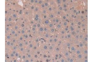 Detection of CA2 in Rat Liver Tissue using Polyclonal Antibody to Carbonic Anhydrase II (CA2) (CA2 抗体  (AA 1-260))