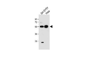 All lanes : Anti-hG5L-D3 at 1:1000 dilution Lane 1: SH-SY5Y whole cell lysate Lane 2: Hela whole cell lysate Lysates/proteins at 20 μg per lane. (ATG5 抗体  (N-Term))