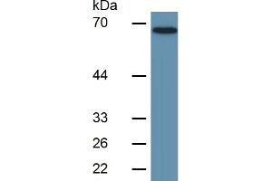 Western Blotting (WB) image for Lipopolysaccharide Binding Protein (LBP) ELISA Kit (ABIN6574276)