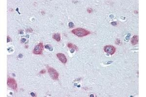 Immunohistochemistry (IHC) image for anti-Phenylalanyl-tRNA Synthetase, beta Subunit (FARSB) (AA 234-342) antibody (ABIN614697) (FARSB 抗体  (AA 234-342))