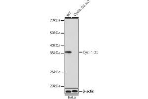 Western blot analysis of extracts from wild type (WT) and Cyclin D1 knockout (KO) HeLa cells, using Cyclin D1 antibody (ABIN7266561) at 1:1000 dilution. (Cyclin D1 抗体)
