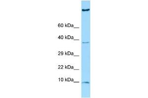 WB Suggested Anti-HGSNAT Antibody Titration: 1.