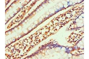 Immunohistochemistry of paraffin-embedded human small intestine tissue using ABIN7145991 at dilution of 1:100 (CCL25 抗体  (AA 24-150))