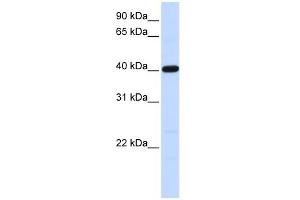 Tropomodulin 3 antibody used at 1 ug/ml to detect target protein. (TMOD3 抗体)