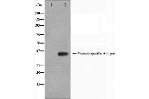 Western blot analysis on mouse heart cell lysate using KLK3 Antibody,The lane on the left is treated with the antigen-specific peptide. (Prostate Specific Antigen 抗体  (Internal Region))