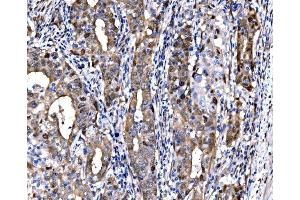 IHC analysis of DLX2 using anti-DLX2 antibody (ABIN7599936). (DLX2 抗体  (AA 13-310))