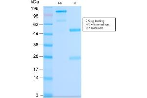 SDS-PAGE Analysis Purified CD63 Rabbit Recombinant Monoclonal Antibody (LAMP3/2990R).