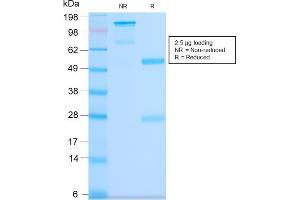 SDS-PAGE Analysis Purified CD63 Rabbit Recombinant Monoclonal Antibody (LAMP3/2990R). (Recombinant CD63 抗体)