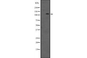 Western blot analysis of PRKD3 expression in HEK293 cells ,The lane on the left is treated with the antigen-specific peptide. (PRKD3 抗体  (N-Term))