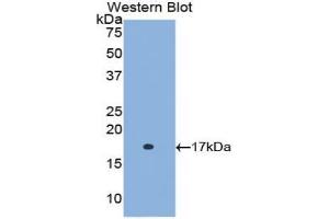 Western blot analysis of the recombinant protein. (Retinol Binding Protein 5 抗体  (AA 1-135))