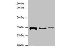 Western blot All lanes: STK16 antibody at 12 μg/mL Lane 1: A549 whole cell lysate Lane 2: Mouse brain tissue Lane 3: A431 whole cell lysate Secondary Goat polyclonal to rabbit IgG at 1/10000 dilution Predicted band size: 35 kDa Observed band size: 35 kDa (STK16 抗体  (AA 1-305))