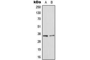 Western blot analysis of Galectin 8 expression in HepG2 (A), NIH3T3 (B) whole cell lysates. (LGALS8 抗体  (Center))