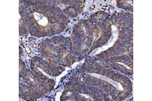 IHC analysis of SARS2 using anti-SARS2 antibody (ABIN7601804). (SARS2 抗体  (AA 46-518))
