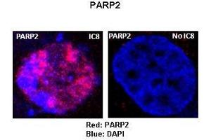 Sample Type :  Rat thyrocytes-FRTL-5   Primary Antibody Dilution :   1:100   Secondary Antibody :  Anti-rabbit-Texas Red   Secondary Antibody Dilution :   1:100   Color/Signal Descriptions :  Red: PARP2 Blue: DAPI   Gene Name :  P Submitted by :  Syed A Morshed, Mount Sinai School of Medicine and James J Peters VA Medical Center (PARP2 抗体  (Middle Region))