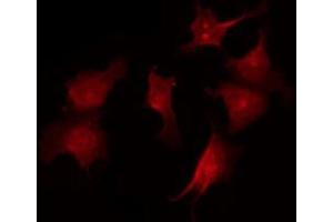 ABIN6267535 staining A2780 by IF/ICC. (CDKN1B 抗体  (pSer10))