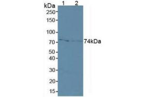 Western blot analysis of (1) Human MCF7 Cells and (2) Human A431 Cells. (MMP2 抗体  (AA 110-660))