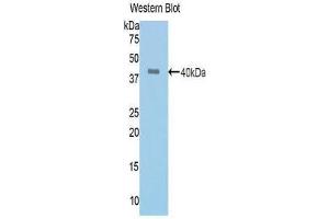 Western Blotting (WB) image for anti-Angiotensin I Converting Enzyme (Peptidyl-Dipeptidase A) 1 (ACE) (AA 504-597) antibody (ABIN1171910) (Angiotensin I Converting Enzyme 1 抗体  (AA 504-597))
