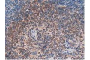 IHC-P analysis of Rat Spleen Tissue, with DAB staining. (ITGAD 抗体  (AA 879-1099))