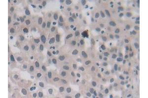 Immunohistochemistry (IHC) image for anti-Methylenetetrahydrofolate Reductase (NAD(P)H) (MTHFR) (AA 1-325) antibody (ABIN7436504)