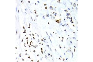 Immunohistochemistry of paraffin-embedded human vermiform appendix using NFKB2 Antibody (ABIN1873900) at dilution of 1:100 (40x lens). (NFKB2 抗体)