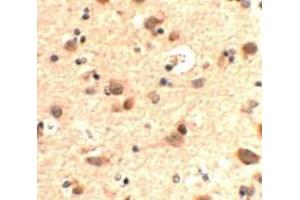 Immunohistochemistry of RUSC2 in human brain tissue with RUSC2 antibody at 5 ug/mL. (RUSC2 抗体  (N-Term))