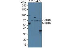 Western blot analysis of (1) Human Serum, (2) Porcine Liver Tissue, (3) Porcine Brain Tissue, (4) Porcine Kidney Tissue and (5) Mouse Liver Tissue. (STAM2 抗体  (AA 1-377))