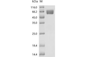 Interleukin 6 Receptor (IL6R) (AA 20-365) (Active) protein (His tag)