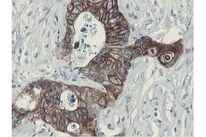 Image no. 5 for anti-Src-like-adaptor 2 (SLA2) antibody (ABIN1500946)