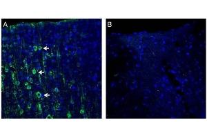 Expression of MAGT1 in rat cortex. (MAGT1 抗体  (Extracellular, N-Term))