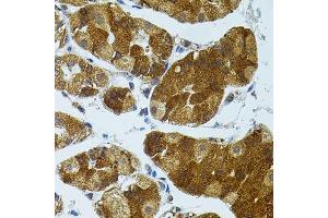 Immunohistochemistry of paraffin-embedded human stomach using CETP antibody.