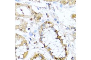 Immunohistochemistry of paraffin-embedded human stomach using TET2 antibody at dilution of 1:100 (40x lens). (TET2 抗体)
