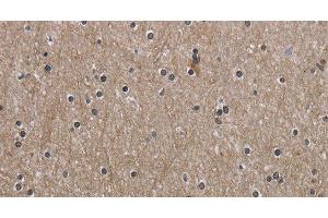 Immunohistochemistry of paraffin-embedded Human brain using PPAT Polyclonal Antibody at dilution of 1:50 (PPAT 抗体)