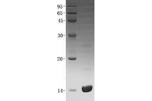 Western Blotting (WB) image for Angiogenin (ANG) (Transcript Variant 2) protein (His tag) (ABIN2714683)