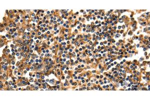 Immunohistochemistry of paraffin-embedded Human tonsil using ANXA5 Polyclonal Antibody at dilution of 1:40 (Annexin V 抗体)