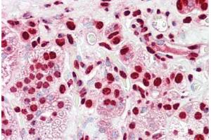 Anti-HnRNP K antibody IHC staining of human adrenal. (HNRNPK 抗体  (AA 1-50))