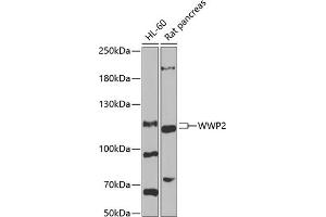 Western blot analysis of extracts of various cell lines, using WWP2 antibody (ABIN6128368, ABIN6150276, ABIN6150277 and ABIN6222535) at 1:1000 dilution. (WWP2 抗体  (AA 1-270))