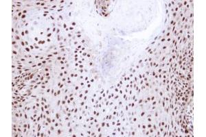 IHC-P Image Immunohistochemical analysis of paraffin-embedded Cal27 xenograft, using NHP2-like protein 1, antibody at 1:100 dilution. (NHP2L1 抗体  (full length))